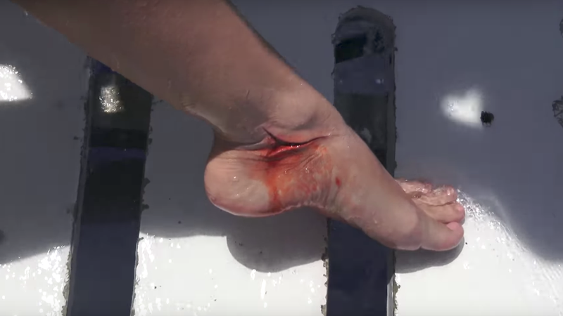 Molly Cavalli’s foot with a very fake looking shark wound (Image: YouTube / CamSoda)
